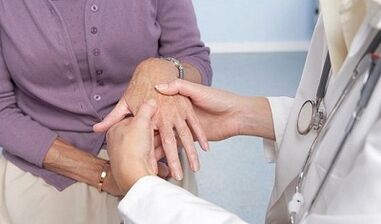 gydytojas tiria artrozės ir artrito turinčius rankų sąnarius