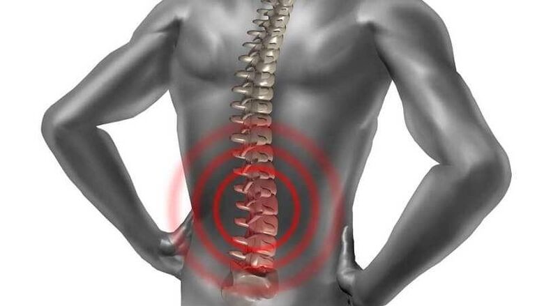 skausmas apatinėje nugaros dalyje
