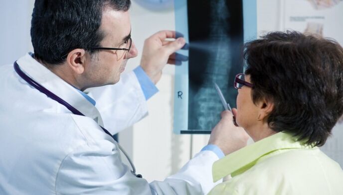 stuburo rentgenas su osteochondroze