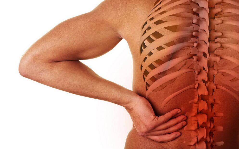 nugaros skausmas dėl osteochondrozės