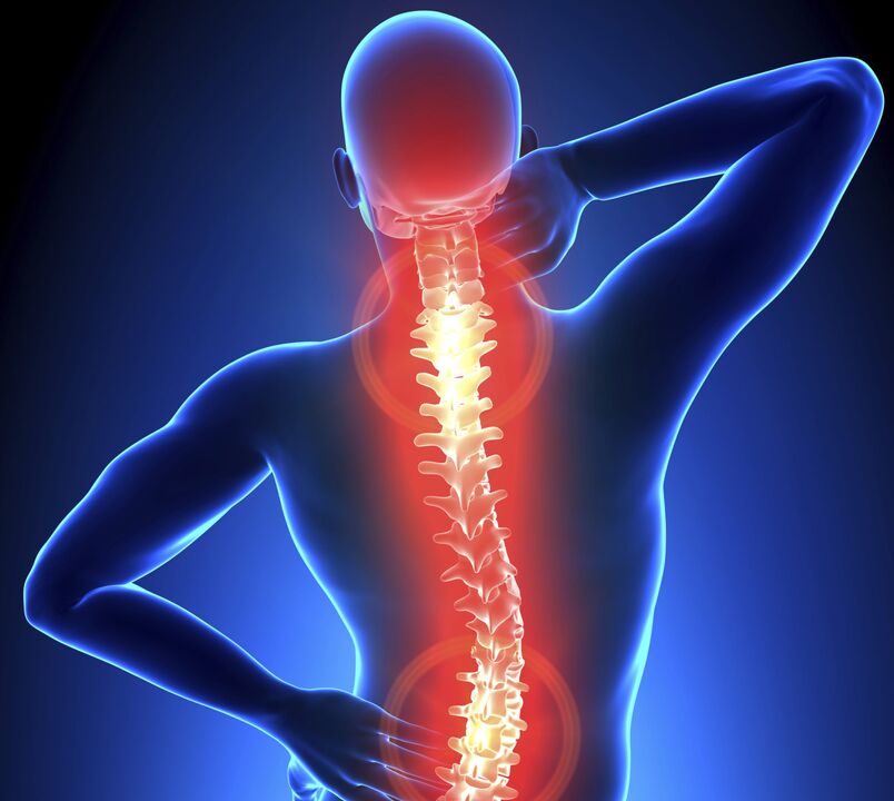 Stuburo osteochondrozė